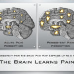 dolore cronico e cervello